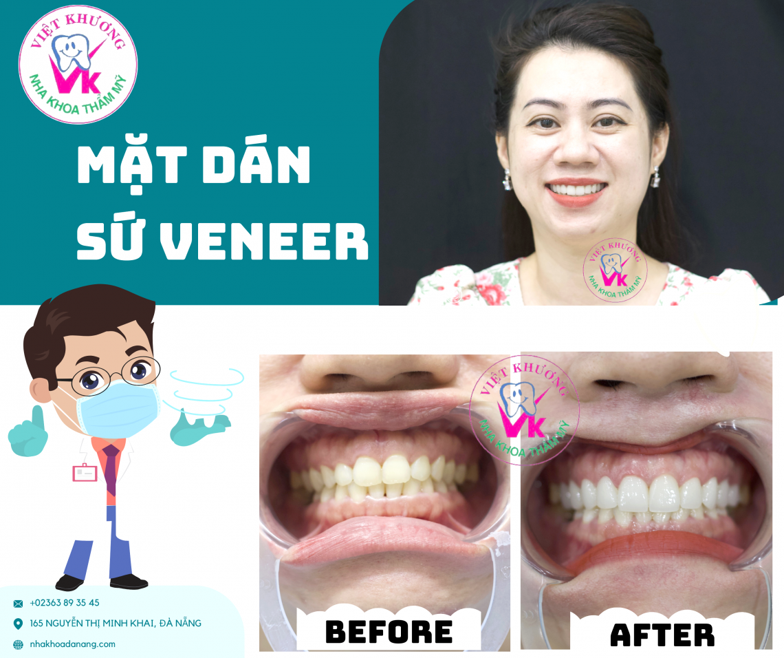 NHA KHOA VIỆT KHƯƠNG