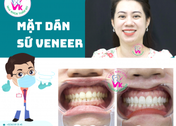 NHA KHOA VIỆT KHƯƠNG